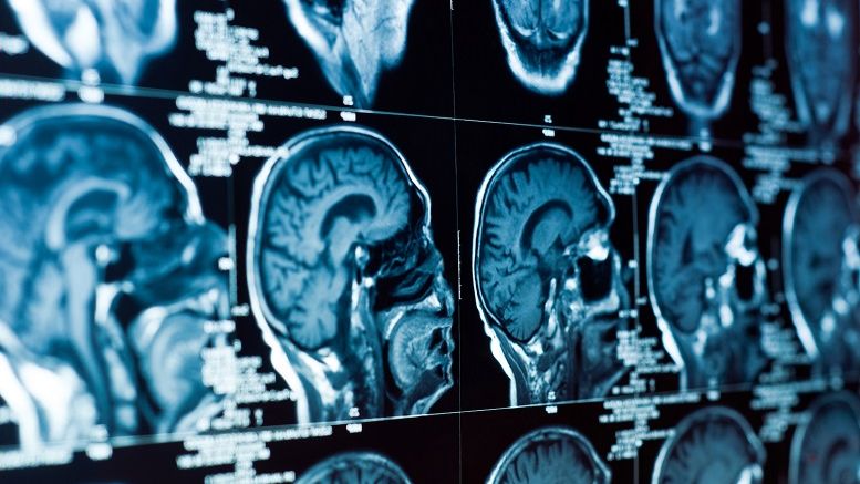 US Government Code-A-Thon to Focus on Blockchain Health Applications