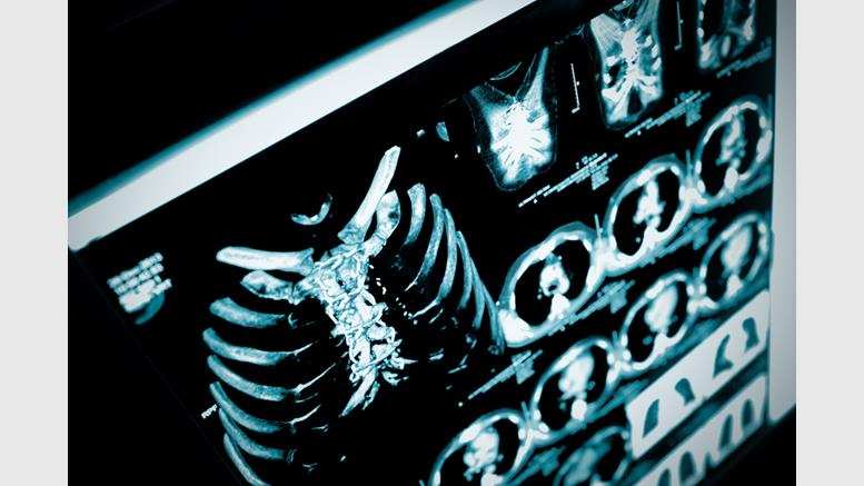 Philips Looks to Bring Blockchain Technology to Healthcare