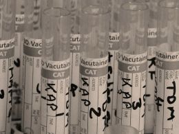 Healthcare: Can the Blockchain Optimize and Secure It?