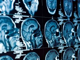 US Government Code-A-Thon to Focus on Blockchain Health Applications